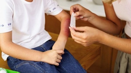 #5TipsLive: Médico jefa de Urgencia nos aconsejará sobre cómo evitar accidentes en casa