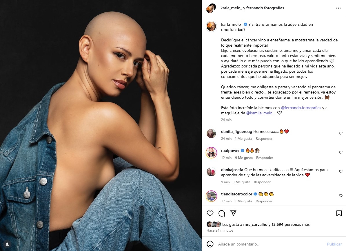 "Valoro tanto estar viva": Karla Melo se muestra empoderada con ...