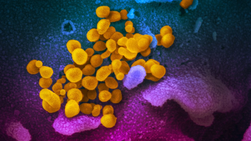 Revelan las imágenes microscópicas del SARS-Cov-2, causante del nuevo coronavirus Revelan las imágenes microscópicas del SARS-Cov-2, causante del nuevo coronavirus