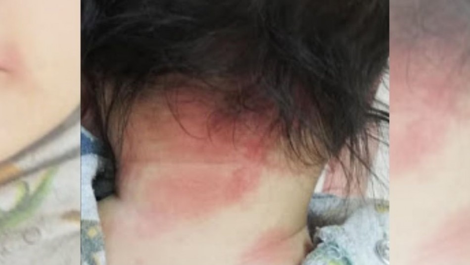 Mamá de bebé rociado con gas pimienta en Bajos de Mena: Mamá de bebé rociado con gas pimienta en Bajos de Mena:
