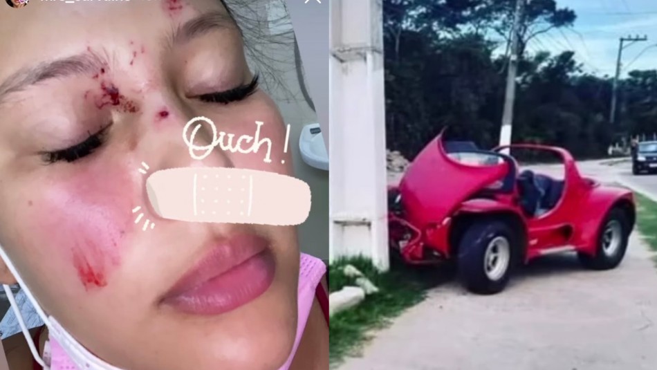 Michelle Carvalho accidentada Michelle Carvalho accidentada