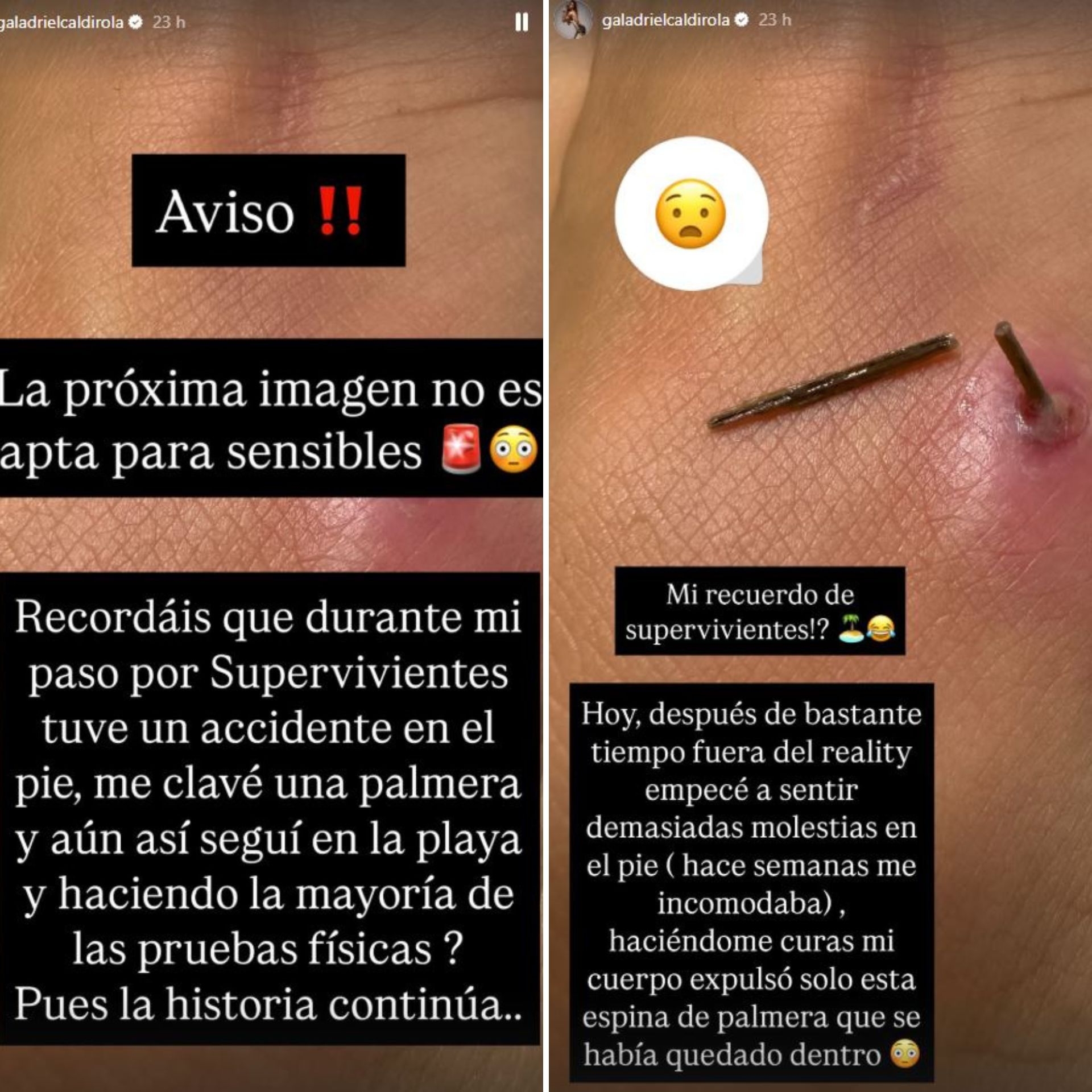 Historias de Gala Caldirola