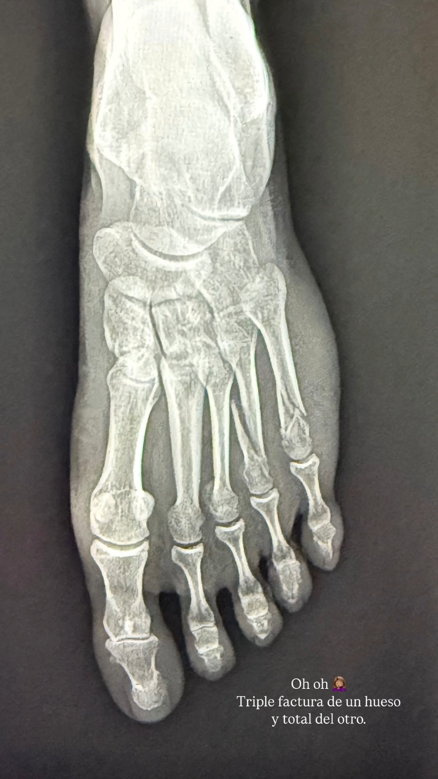 Lesión de Leonor Varela