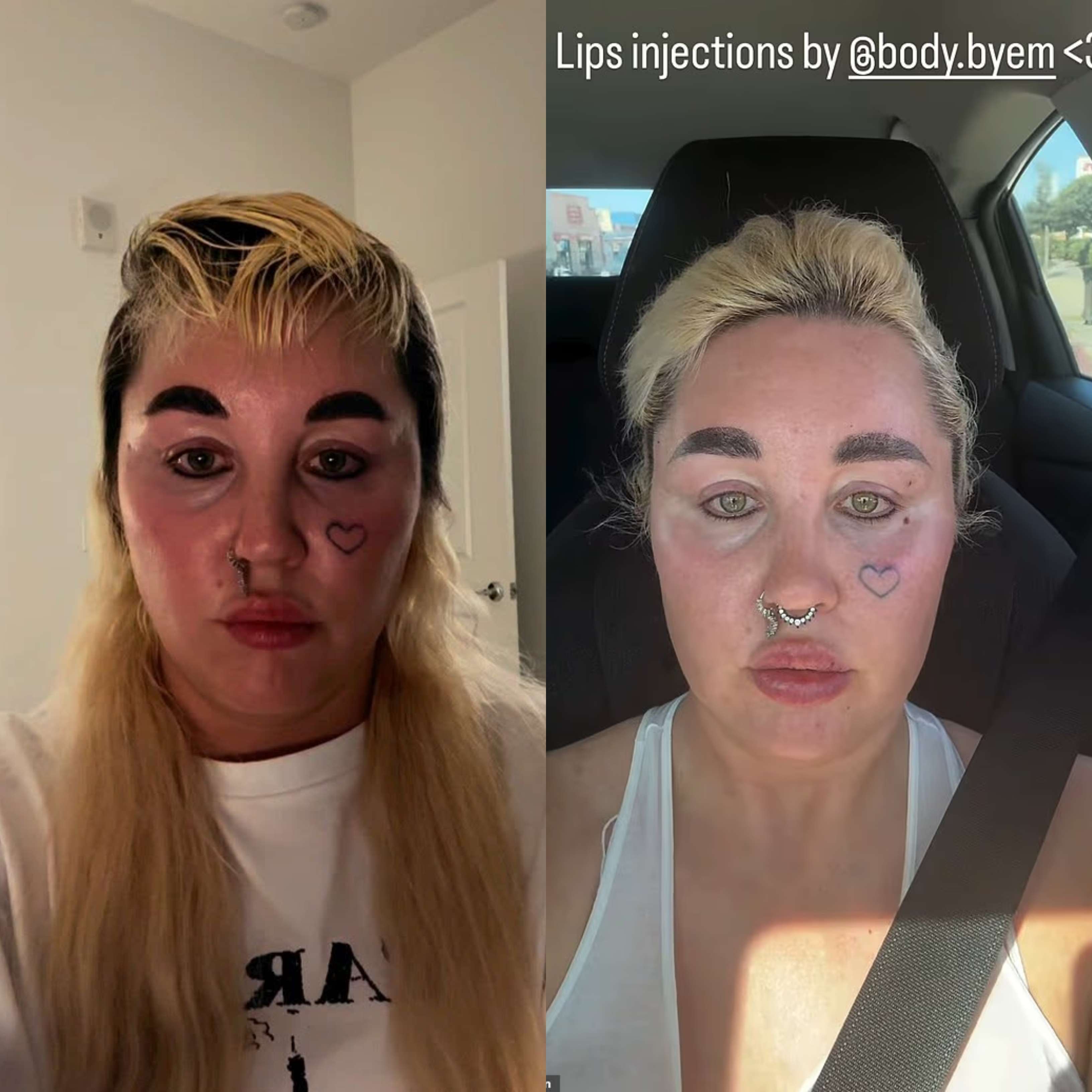 El antes y después de Amanda Bynes/Instagram