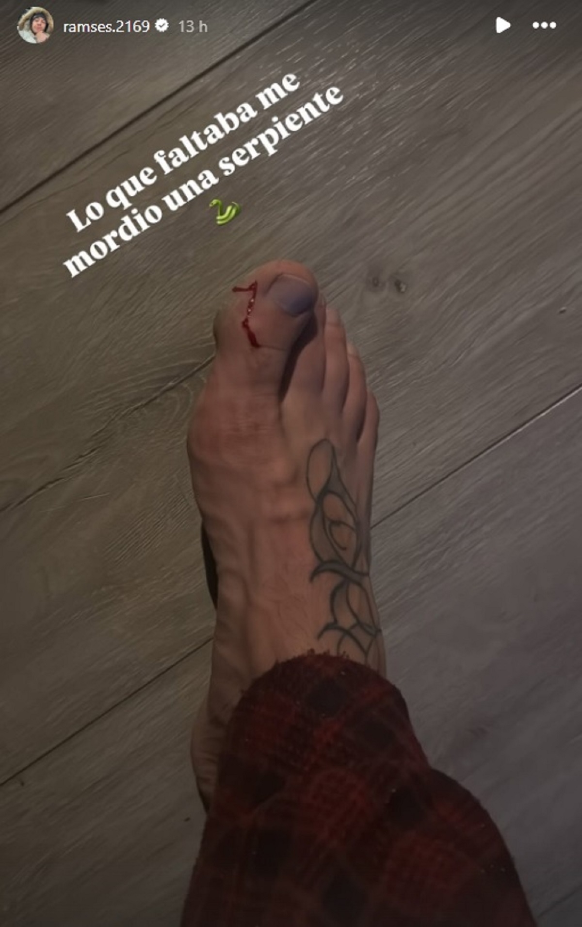 La lesión de Lucas Lama / Instagram