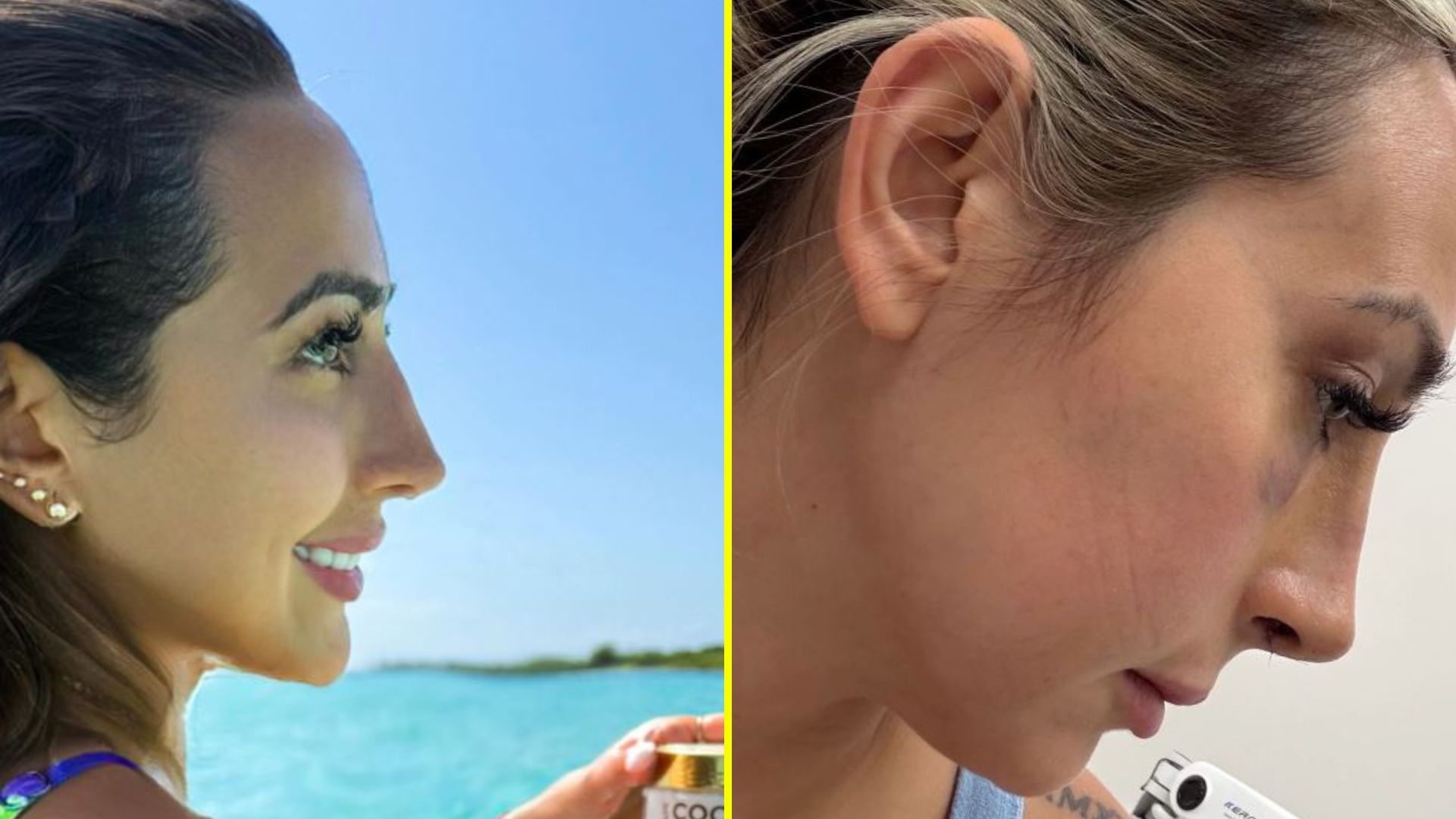 El antes y después de Rebeca Naranjo