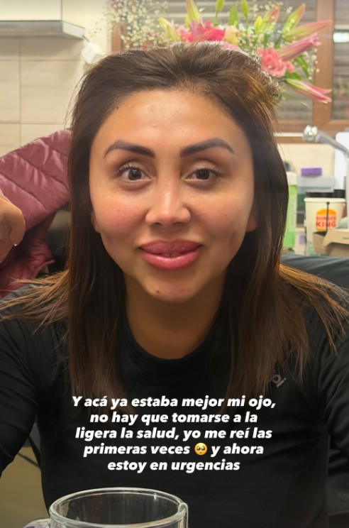 Una foto compartida por Naya Fácil con su problema en el ojo / Instagram